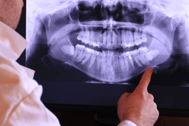 Best Emergency Dentist for Special Needs Patients in Palm Shores, FL